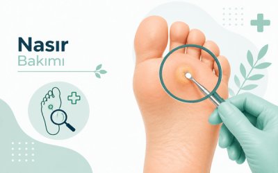 Nasır Bakımı - Nasır Bakımı hakkında medikal bilgiler ve freze ile mekanik temizlik için yazımızı okuyun. Baskı giderici koruyucu öneriler sunuyoruz.