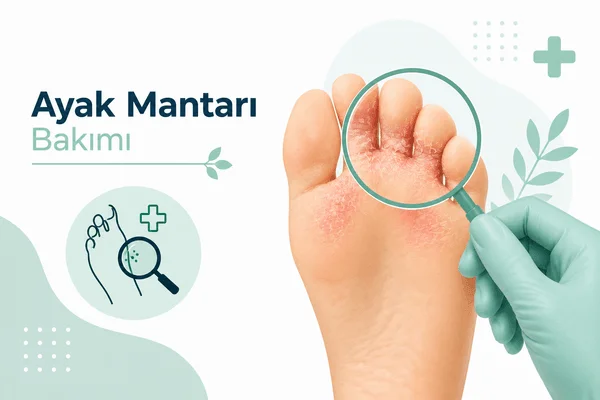 Ayak Mantarı Bakımı Hizmeti - Parmak araları ve ayak derisindeki nem, soyulma ve çatlak görünümünün podolojik 