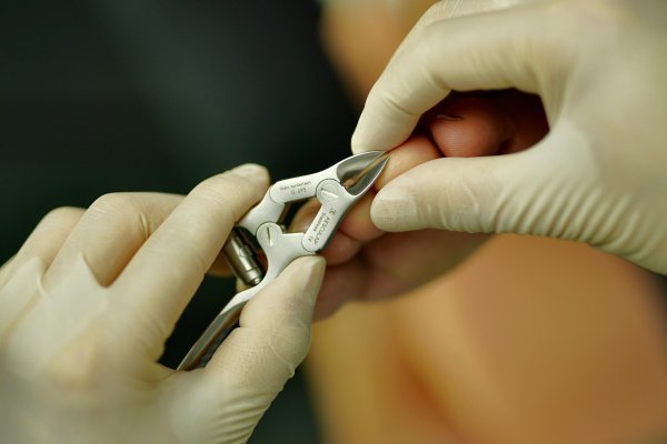 Tırnak Deformasyonu Bakımı